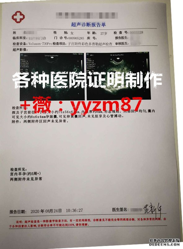 <b>一个月的怀孕b超单制作</b>